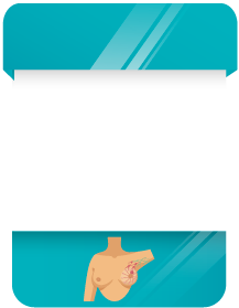 Imagem de uma card sobre Carcinoma